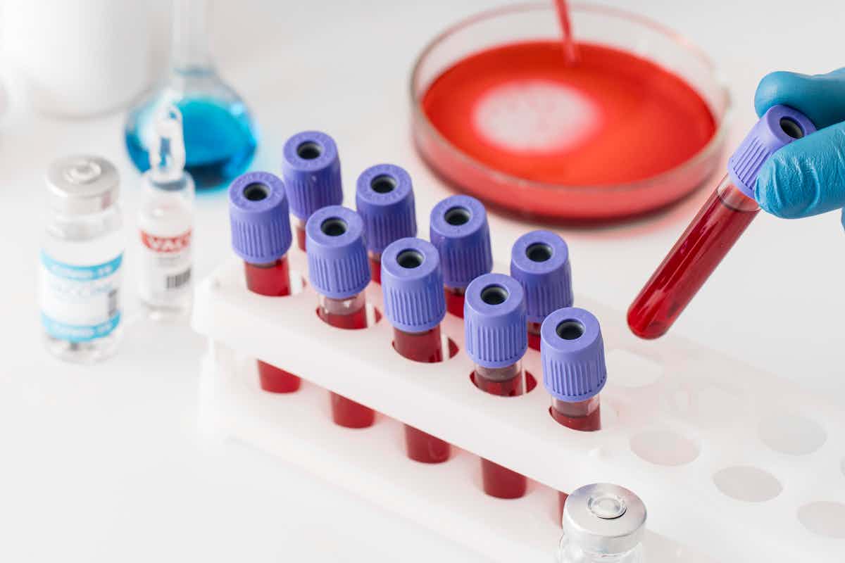 Lab Test